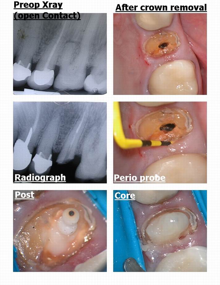 DM osseous pg 1.jpg